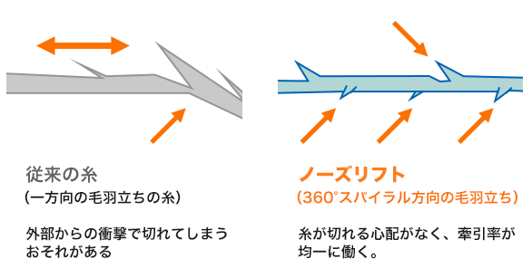 プチ鼻尖形成(ノーズリフト)の糸