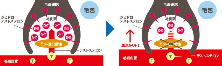 ミノキシジルとフィナステリド
