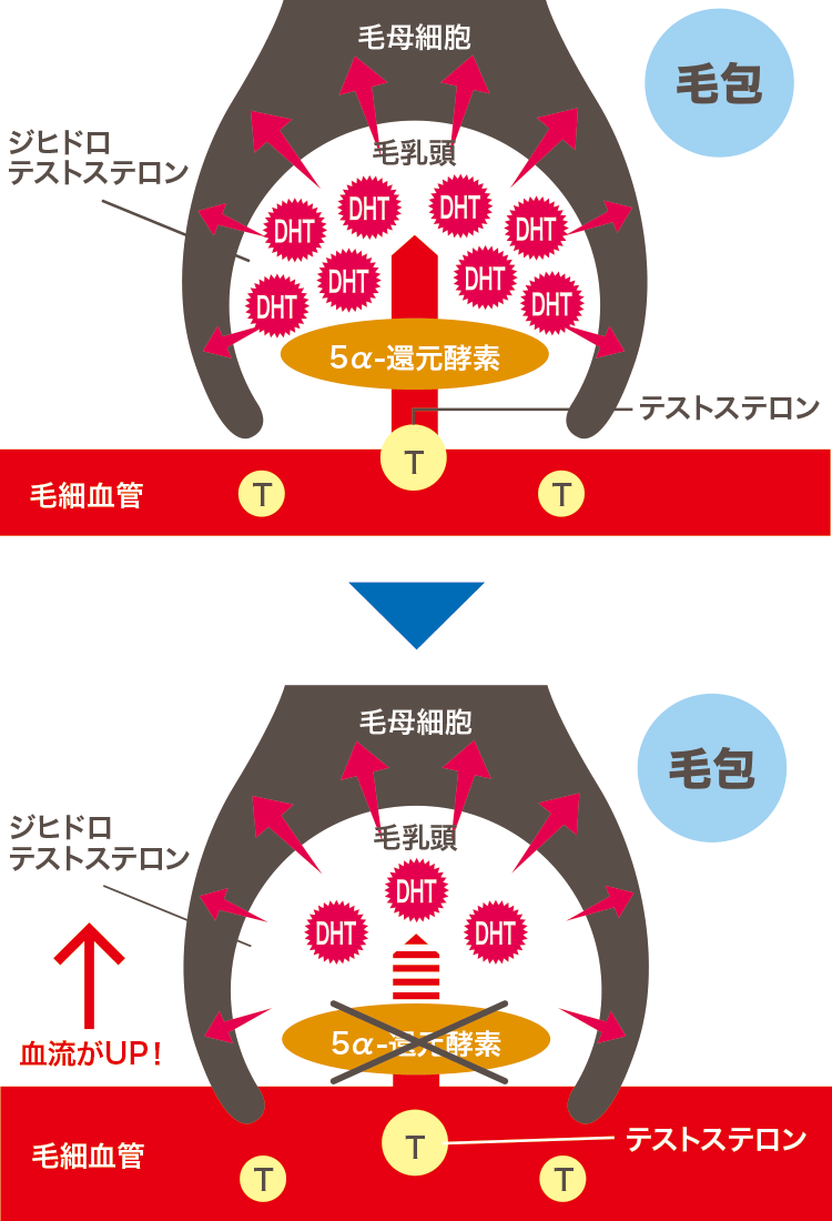 ミノキシジルとフィナステリド