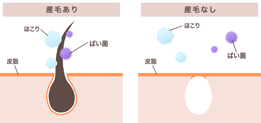 産毛ありと産毛なしの比較図